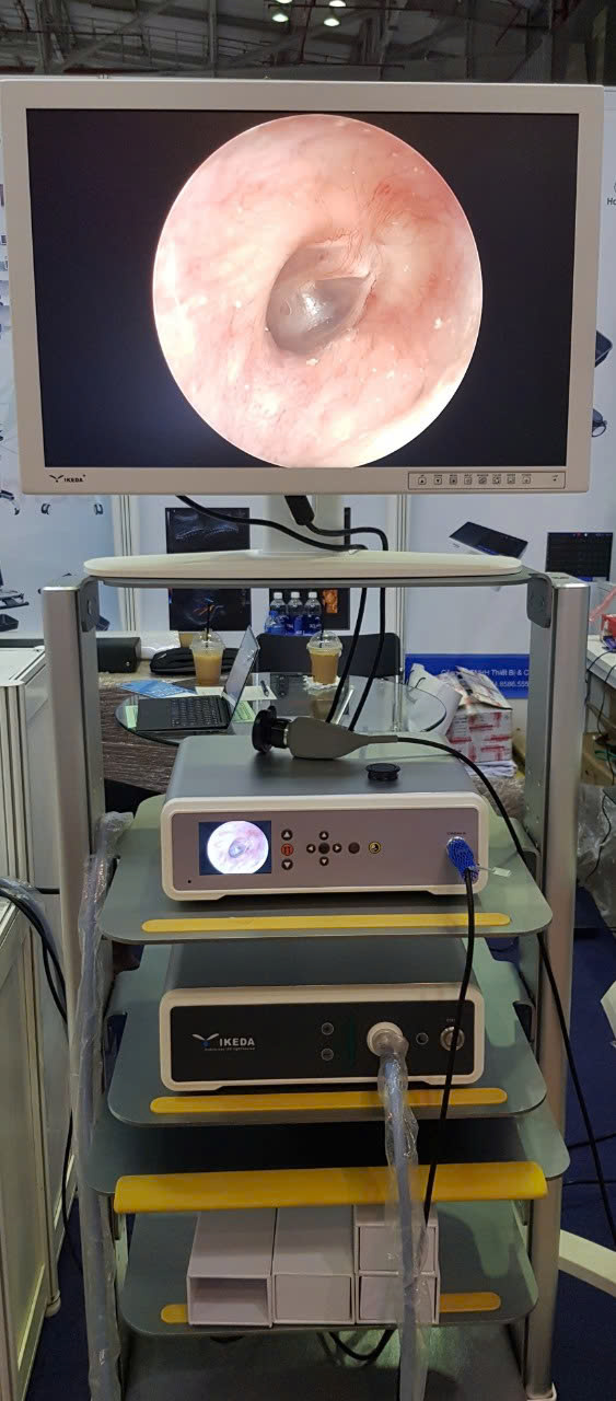 MÁY NỘI SOI TAI MŨI HỌNG