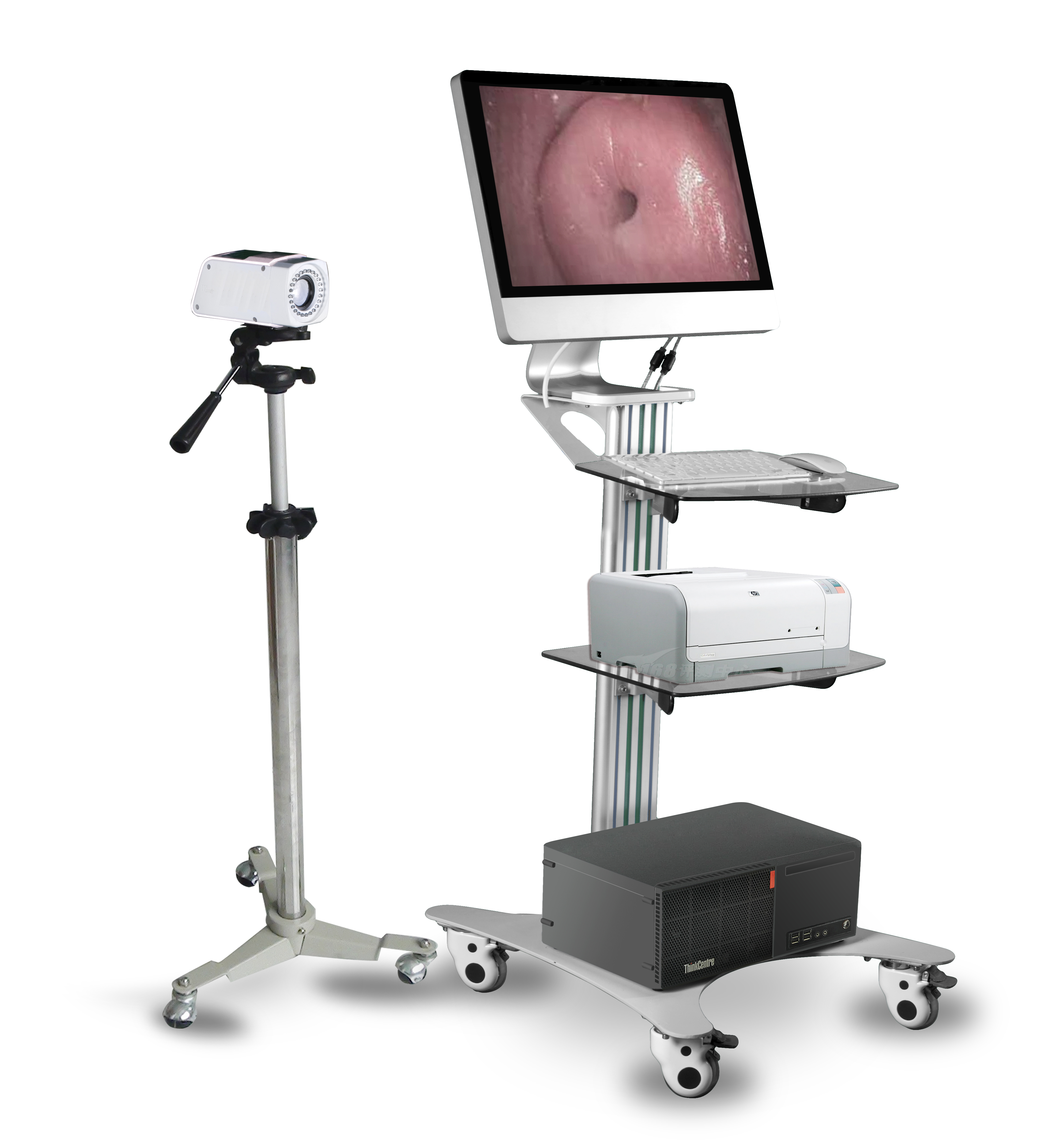 Digital Optical Colposcope