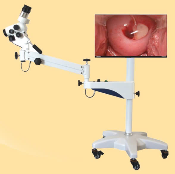 Máy Soi Cổ Tử cung Colposcope machine
