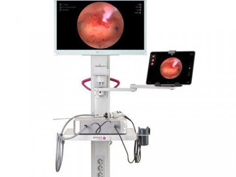 Hysteroscopy device